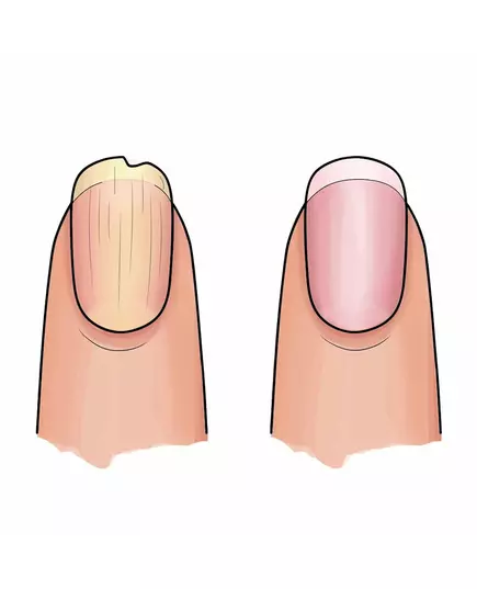 Желтый набор для сухих ногтей Herome essential dry and ridging nails, изображение 4